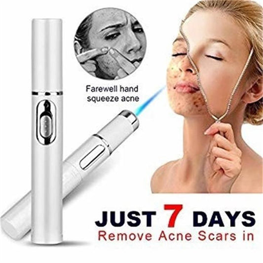 Blue Light Acne Treatment