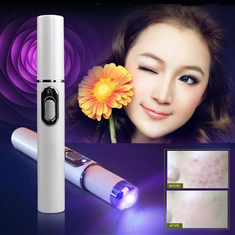 Blue Light Acne Treatment