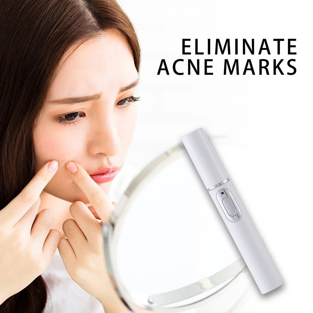 Blue Light Acne Treatment