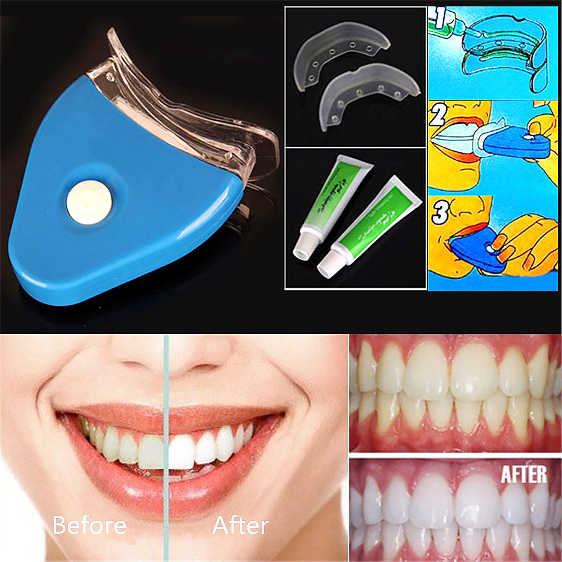 LED Tooth Whitening Gel